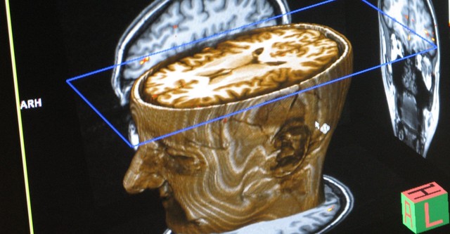 El laberinto de la dislexia