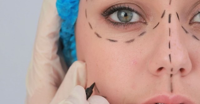 Pesadelos da Cirurgia Plástica