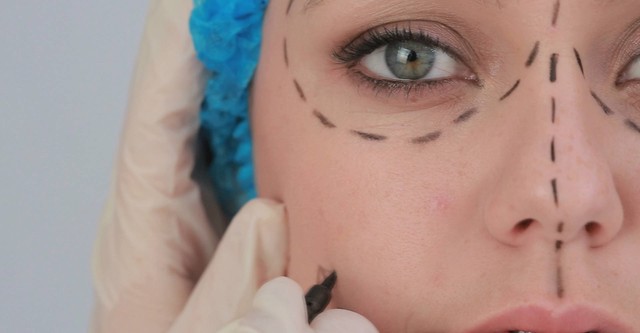 Plastic Surgery Nightmares