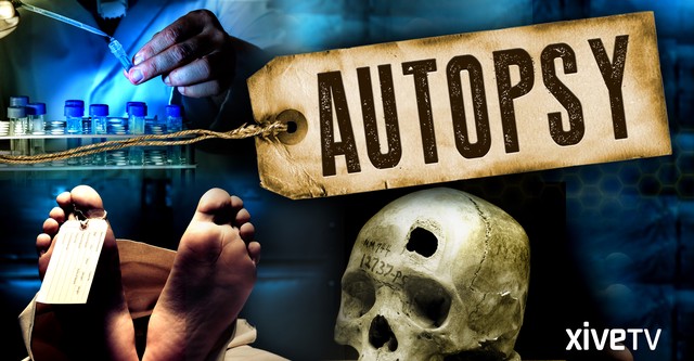 Autopsy: Confessions of a Medical Examiner