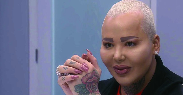 Botched