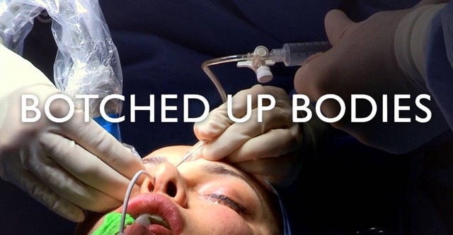 Botched Up Bodies