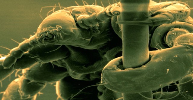 Life on Us: A Microscopic Safari