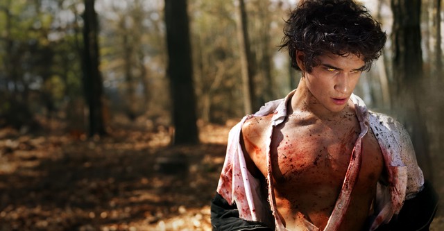 Teen Wolf: Farkasbőrben