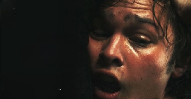 Bleeding