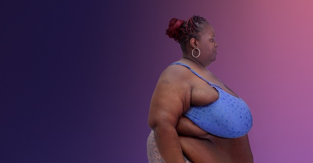 Mi vida con 300 kilos