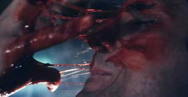 The Ballad of Skinless Pete