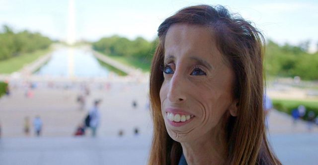 A Brave Heart: The Lizzie Velasquez Story