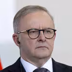 Anthony Albanese
