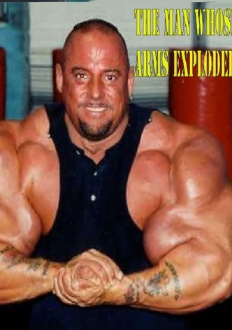 The Man Whose Arms Exploded