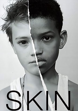 Skin (Kurzfilm) [dt./OV]
