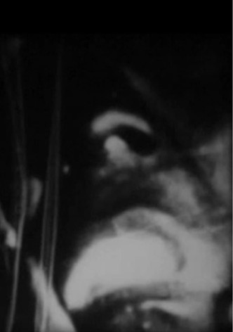 Macula