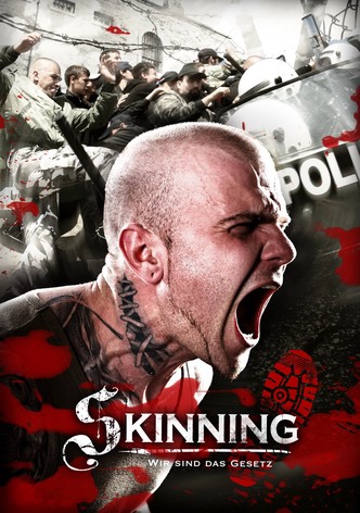 Skinning - Wir sind das Gesetz