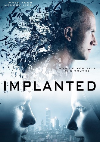 Implanted