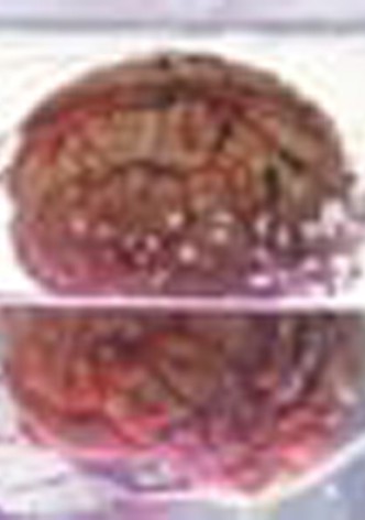 Victim of the Brain
