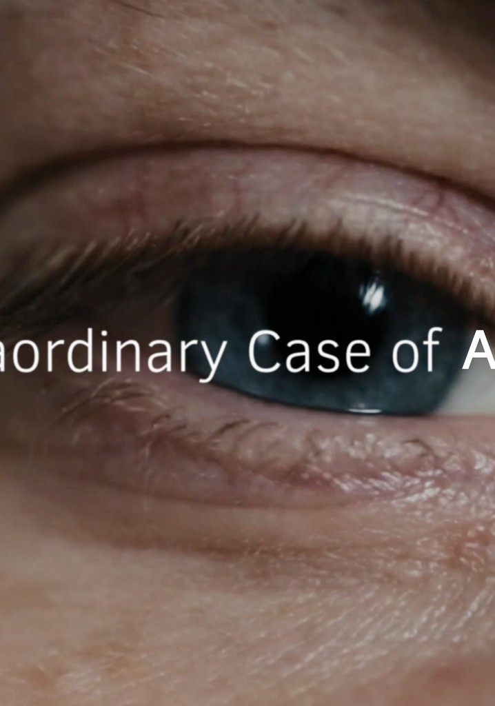 The Extraordinary Case of Alex Lewis