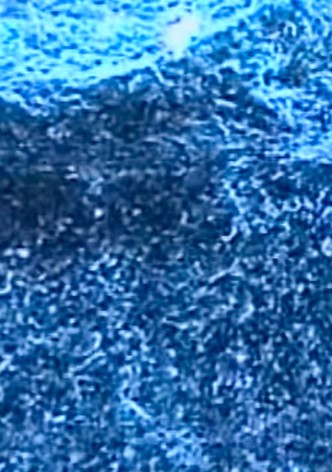 Microscopías