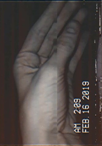 Hand
