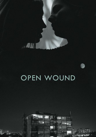 Open Wound