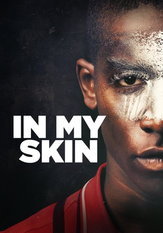 In my Skin