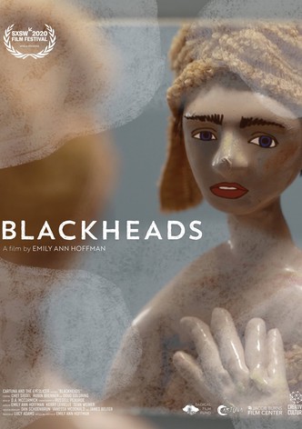 Blackheads