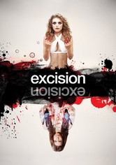 Excision