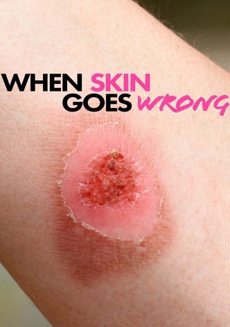 When Skin Goes Wrong Season 1