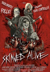 Skinned Alive