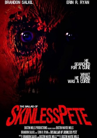 The Ballad of Skinless Pete