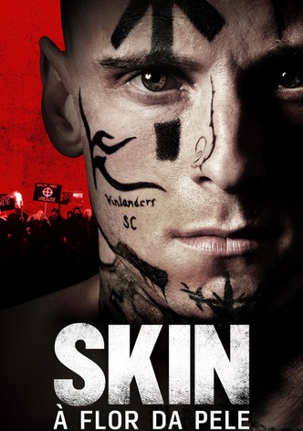 Skin - História Proibida