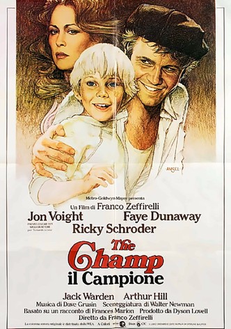 Il campione