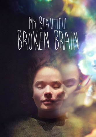 My Beautiful Broken Brain
