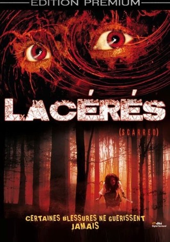 Lacérés