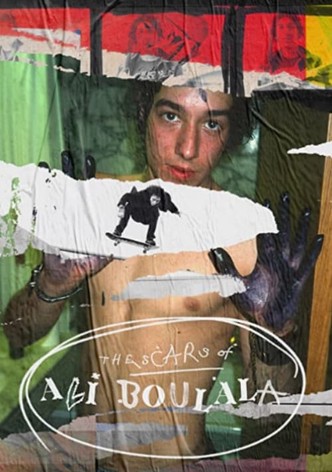 The Scars of Ali Boulala