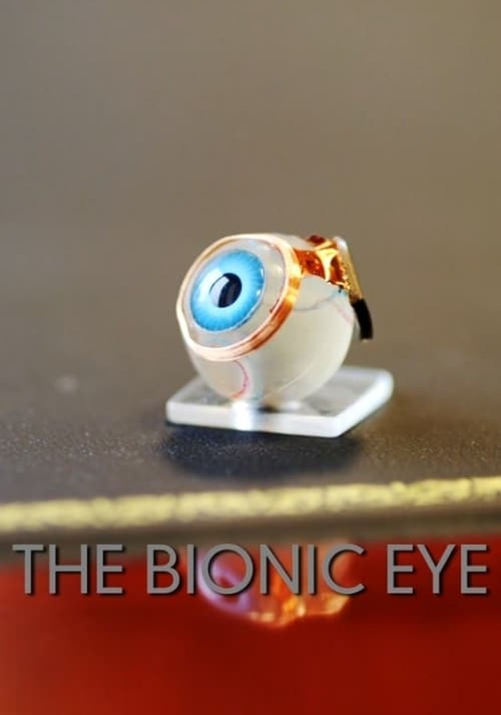The Bionic Eye