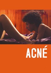 Acné