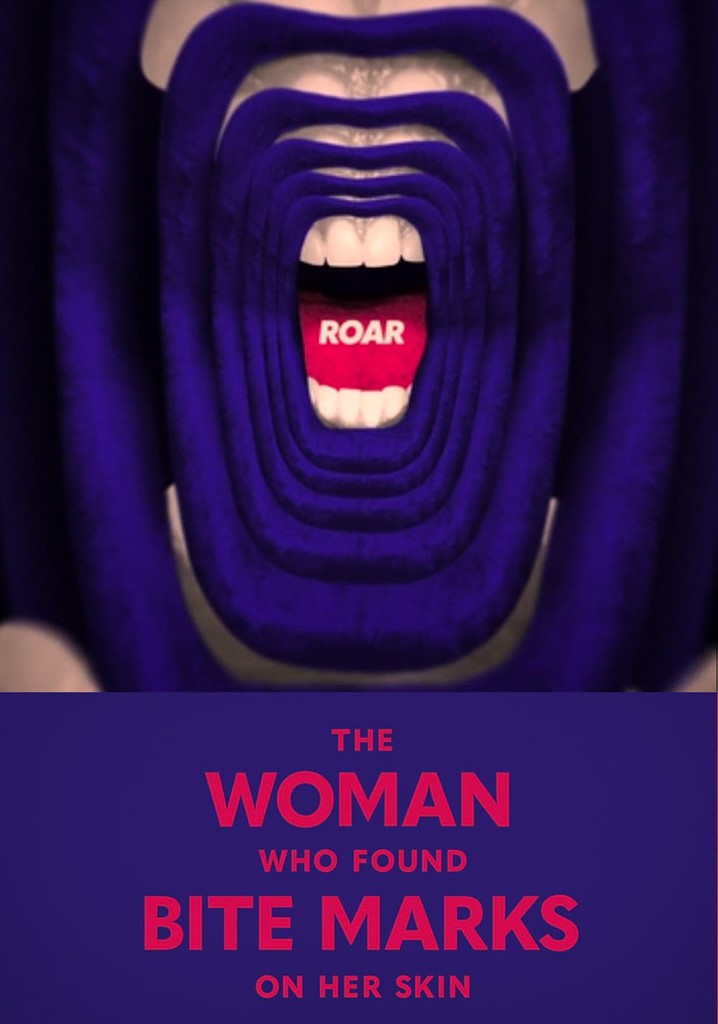 Roar: The Woman Who Found Bite Marks On Her Skin