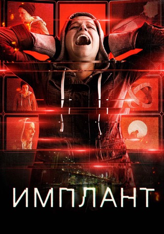 Имплант