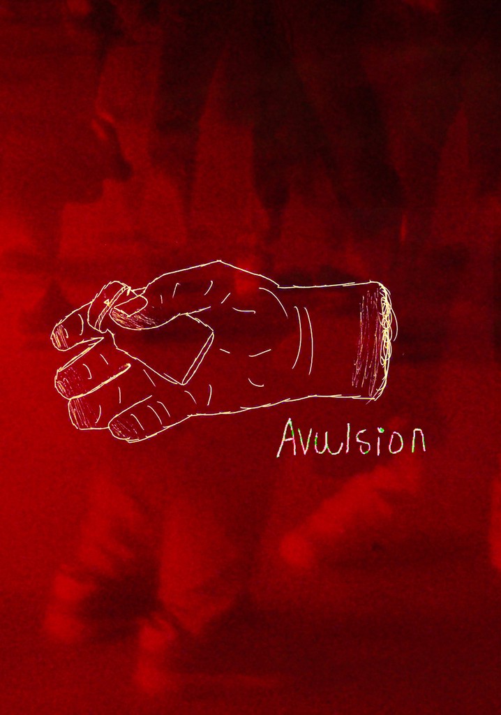 Avulsion