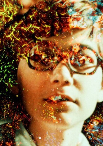 Pigment-Dispersion Syndrome