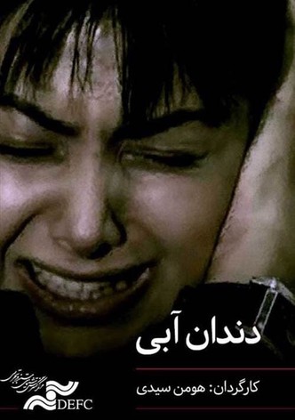 دندان آبی