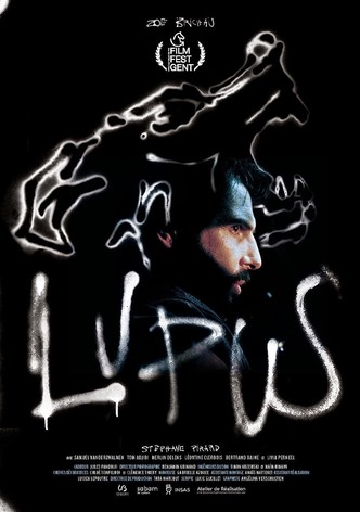 Lupus