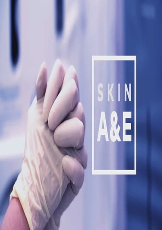 SKIN A&E