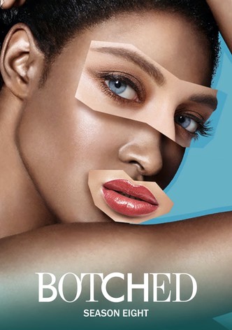 Botched full episodes online new arrivals