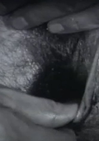 Black Balls