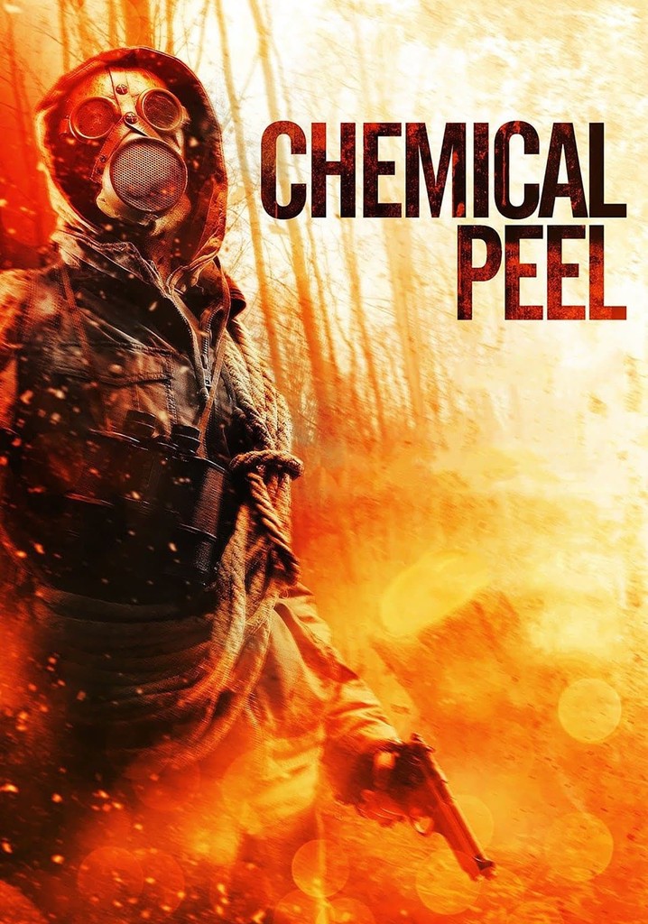 Chemical Peel