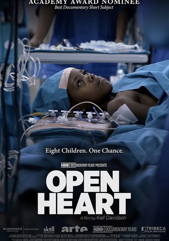 Open Heart