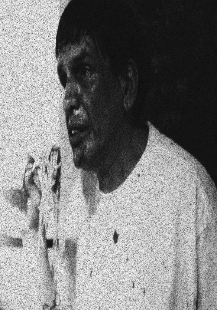 Oh Dear Lord What is Wrong With Your Face?