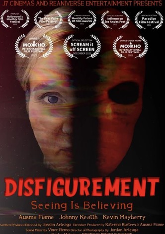 Disfigurement