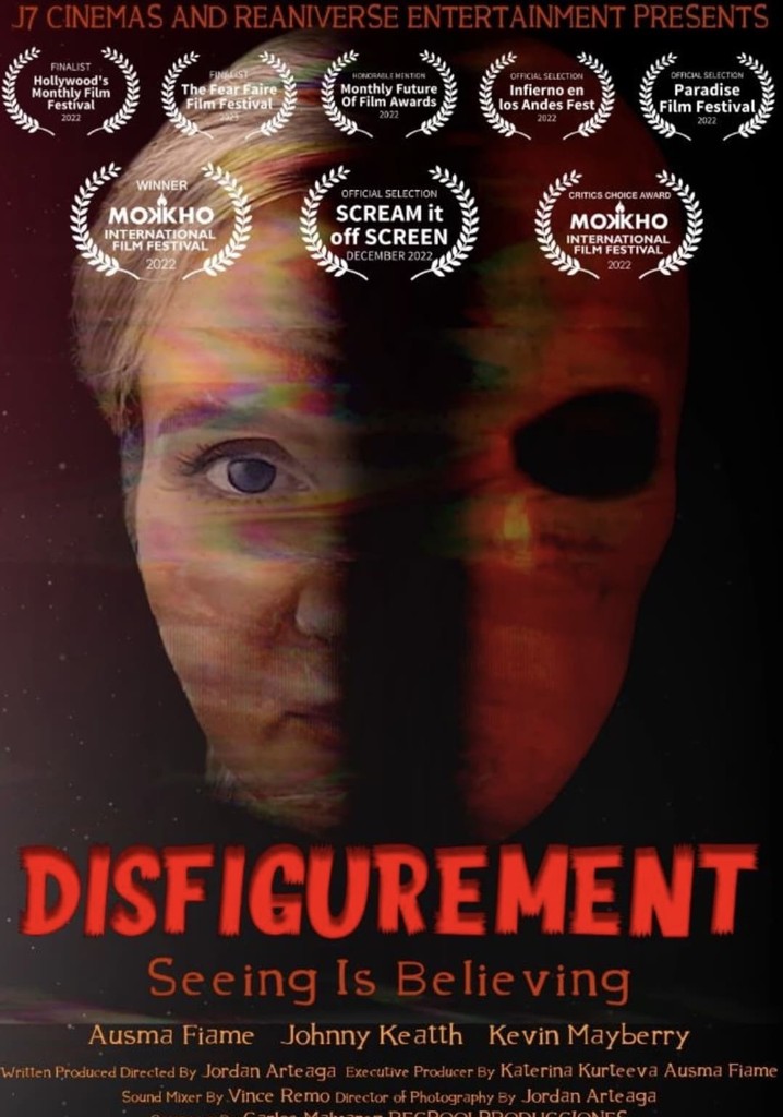 Disfigurement